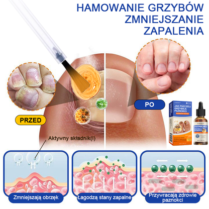 🐝🐝Furzero™ Bienengift Nagelpilz Leczenie: Całkowite rozwiązanie problemu grzybicy paznokci🌟👣👣👣