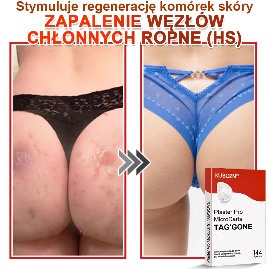 KUBOZN® Mikroigłowy Botaniczny Plaster na Usuwanie Brodawek Skórnych✨✨✨
