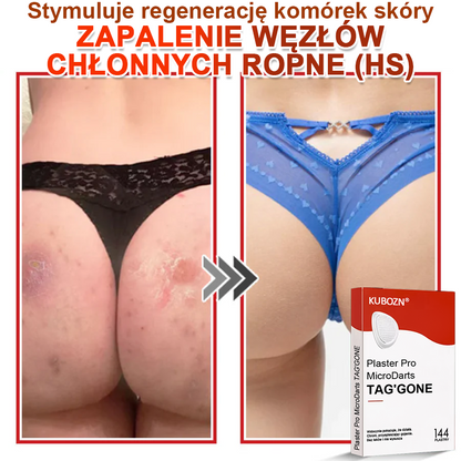KUBOZN® Mikroigłowy Botaniczny Plaster na Usuwanie Brodawek Skórnych✨✨✨
