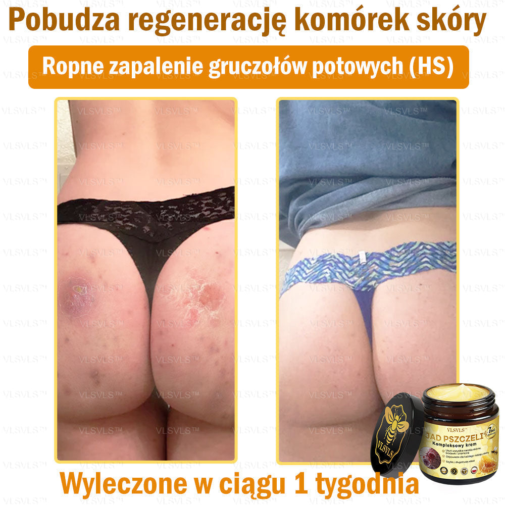 🇵🇱VLSVLS™ Krem Komprehensywny z Jadami Pszczół 🇵🇱 Rekomendowany przez Dermatologów🇵🇱
