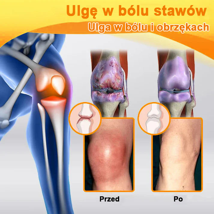 ✅Oficjalny sklep: Ouryard™ Olej magnezowy i miód w sprayu do naprawy stawów👨‍⚕️Zatwierdzony przez Polską Agencję Leków, Wyrobów Medycznych i Produktów Biologicznych (URPL)🔥