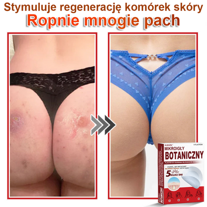 KUBOZN® Mikroigłowy botaniczny środek do usuwania narośli skórnych ✅✅✅wyprodukowano w Polsce✅