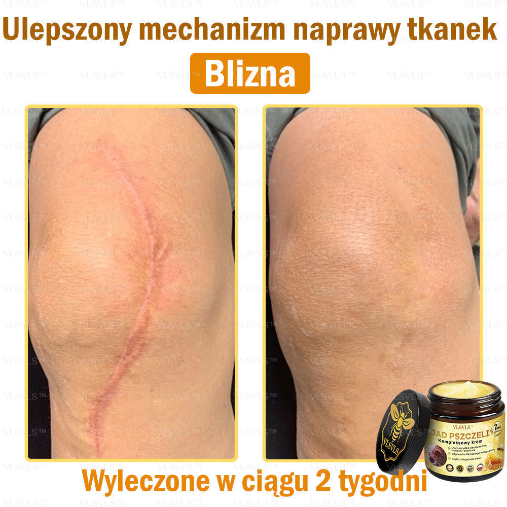 🇵🇱VLSVLS™ Krem Komprehensywny z Jadami Pszczół 🇵🇱 Rekomendowany przez Dermatologów🇵🇱