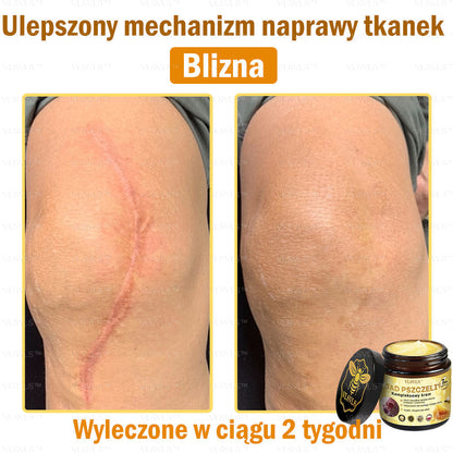 🇵🇱VLSVLS™ Krem Komprehensywny z Jadami Pszczół 🇵🇱 Rekomendowany przez Dermatologów🇵🇱