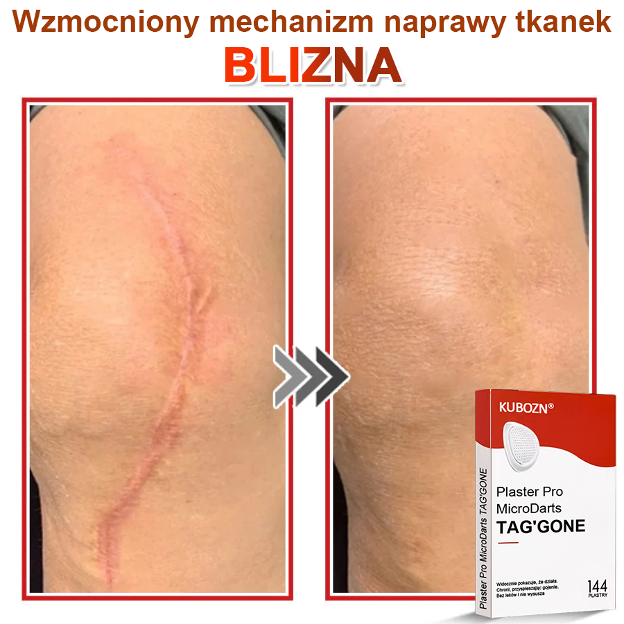 KUBOZN® Mikroigłowy Botaniczny Plaster na Usuwanie Brodawek Skórnych✨✨✨