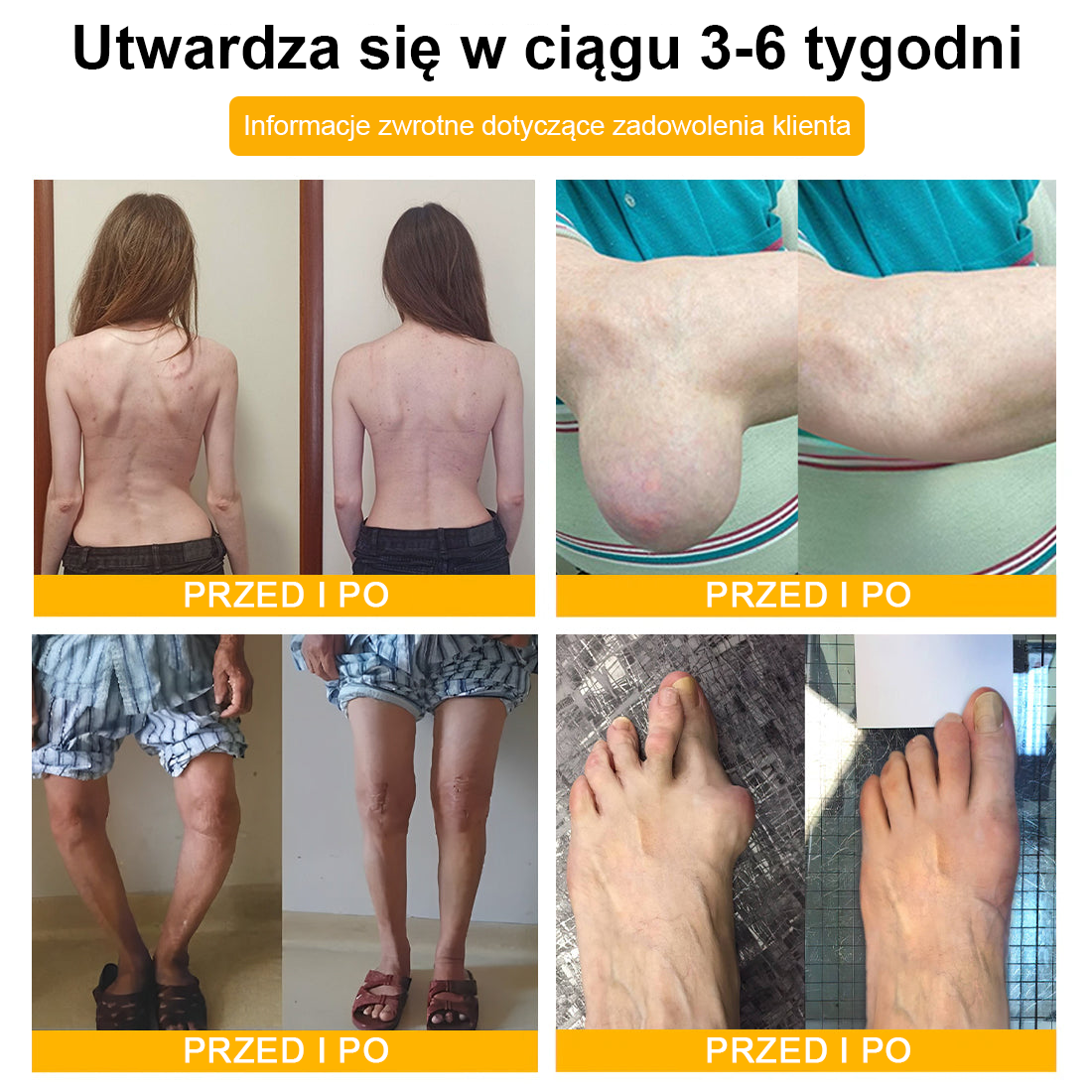 TLOPA® Toksyna botulinowa i jad pszczeli Krem przeciwbólowy do gojenia kości🐝