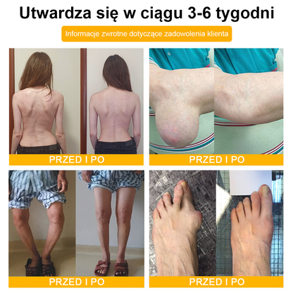 TLOPA® Toksyna botulinowa i jad pszczeli Krem przeciwbólowy do gojenia kości🐝