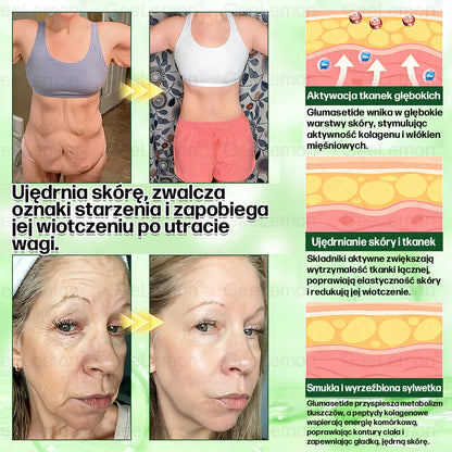 👩‍⚕️Oficjalny Sklep | 🎁 GeeLemon® 𝐆𝐥𝐮𝐦ase𝐭𝐢𝐝𝐞 𝟖 𝐰 𝟏 Smukły i Zdrowy Nano Plaster z Mikronakłuciami 🇵🇱(Tylko raz dziennie, widoczne zmiany już w 7 dni)✅ Na otyłość, 🅛🅞🅞🅢🅔 🅢🅚🅘🅝 wiotką skórę, cukrzycę, bezdech senny, problemy ze stawami i wiele więcej🔥🔥🔥