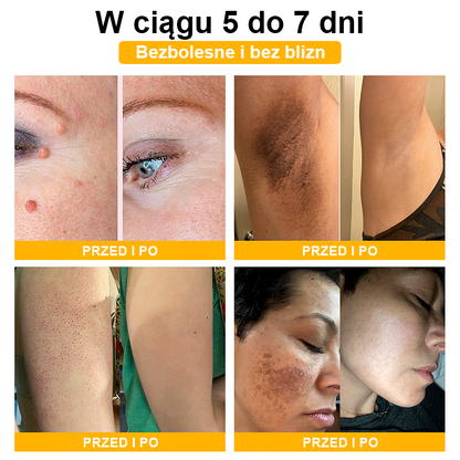 🏵️Turonu™ leczniczy krem do skóry z jadem pszczelim (zalecany przez AAD)🏵️