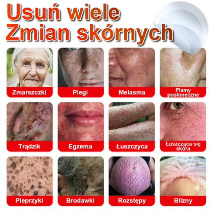 KUBOZN® Mikroigłowy botaniczny środek do usuwania narośli skórnych ✅✅✅wyprodukowano w Polsce✅