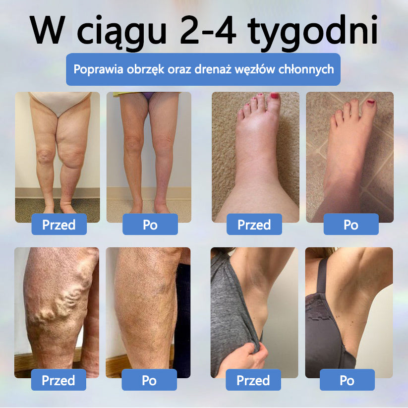 Detoksykujący krem ziołowy z czarnym kminkiem Cvreoz®🩹🩹🩹