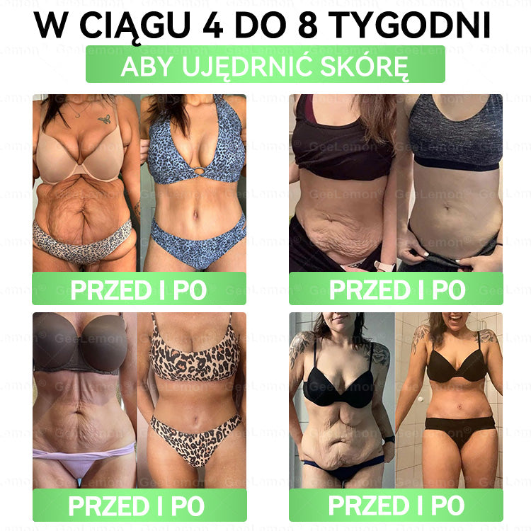 👩‍⚕️Oficjalny Sklep | 🎁 GeeLemon® 𝐆𝐥𝐮𝐦ase𝐭𝐢𝐝𝐞 𝟖 𝐰 𝟏 Smukły i Zdrowy Nano Plaster z Mikronakłuciami 🇵🇱(Tylko raz dziennie, widoczne zmiany już w 7 dni)✅ Na otyłość, 🅛🅞🅞🅢🅔 🅢🅚🅘🅝 wiotką skórę, cukrzycę, bezdech senny, problemy ze stawami i wiele więcej🔥🔥🔥