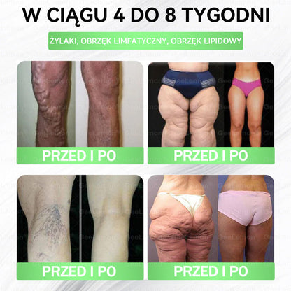👩‍⚕️Oficjalny Sklep | 🎁 GeeLemon® 𝐆𝐥𝐮𝐦ase𝐭𝐢𝐝𝐞 𝟖 𝐰 𝟏 Smukły i Zdrowy Nano Plaster z Mikronakłuciami 🇵🇱(Tylko raz dziennie, widoczne zmiany już w 7 dni)✅ Na otyłość, 🅛🅞🅞🅢🅔 🅢🅚🅘🅝 wiotką skórę, cukrzycę, bezdech senny, problemy ze stawami i wiele więcej🔥🔥🔥