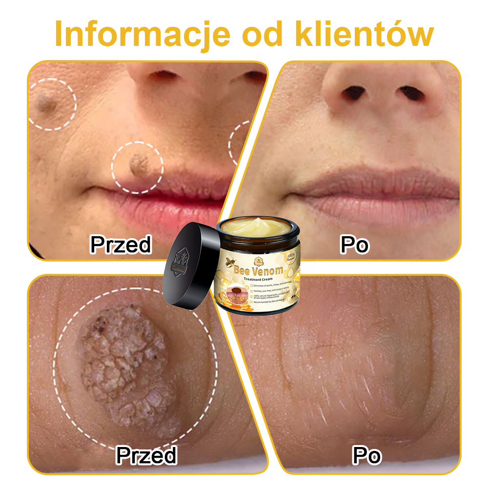 🏵️Turonu™ leczniczy krem do skóry z jadem pszczelim (zalecany przez AAD)🏵️