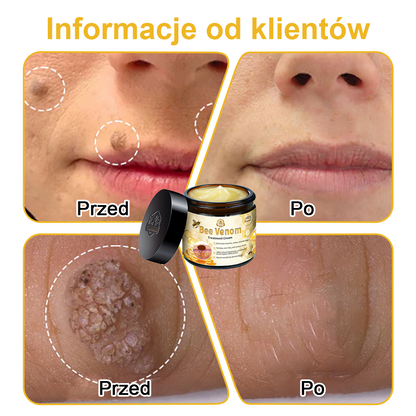 🏵️Turonu™ leczniczy krem do skóry z jadem pszczelim (zalecany przez AAD)🏵️