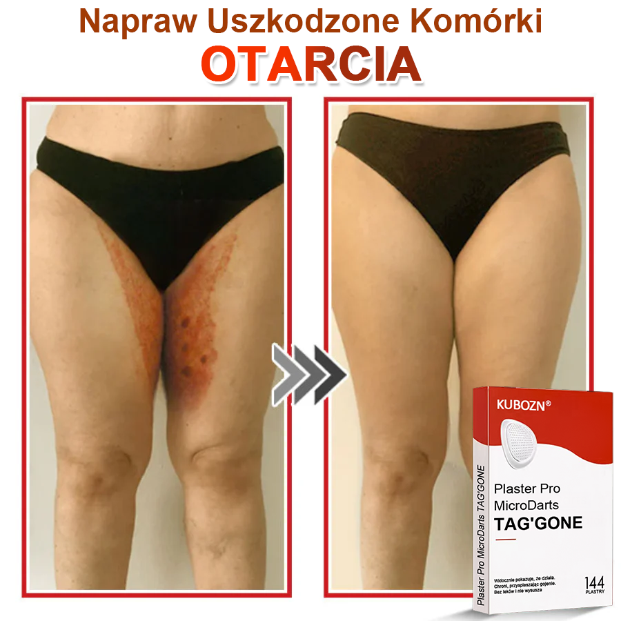 KUBOZN® Mikroigłowy Botaniczny Plaster na Usuwanie Brodawek Skórnych✨✨✨