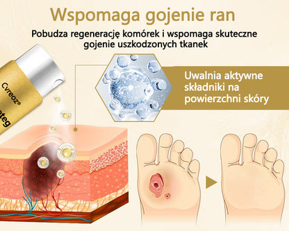 Cvreoz® Leczniczy spray z jadem pszczelim do gojenia i regeneracji ran na dłoniach i stopach🌿🌿🌿