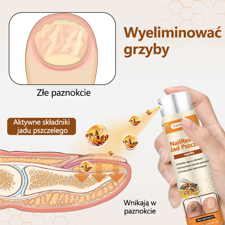Spray z jadem pszczelim – skuteczny w leczeniu infekcji grzybiczych i zapalenia paznokci🎁