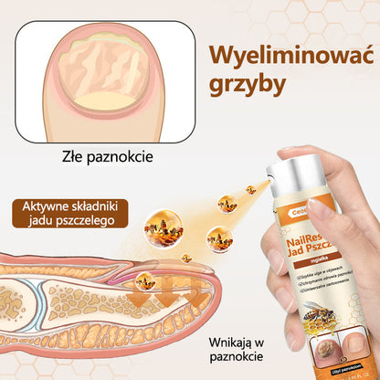 Spray z jadem pszczelim – skuteczny w leczeniu infekcji grzybiczych i zapalenia paznokci🎁