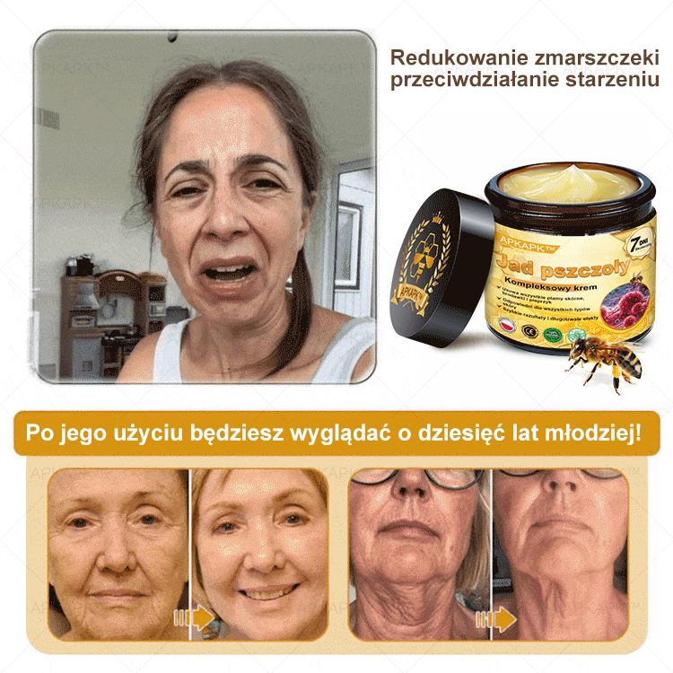 ΑPΚΑPK™ Jad Pszczoły Kompleksowy Krem🥇🥇pomaga w leczeniu problemów skórnych, takich jak: zmarszczki, blizny, plamy pigmentacyjne, rozstępy, trądzik, łuszczyca, egzema, zmiany skórne, podrażnienia, stany zapalne i inne problemy skórne🔥🔥🔥