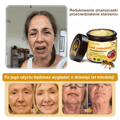 ΑPΚΑPK™ Jad Pszczoły Kompleksowy Krem🥇🥇pomaga w leczeniu problemów skórnych, takich jak: zmarszczki, blizny, plamy pigmentacyjne, rozstępy, trądzik, łuszczyca, egzema, zmiany skórne, podrażnienia, stany zapalne i inne problemy skórne🔥🔥🔥