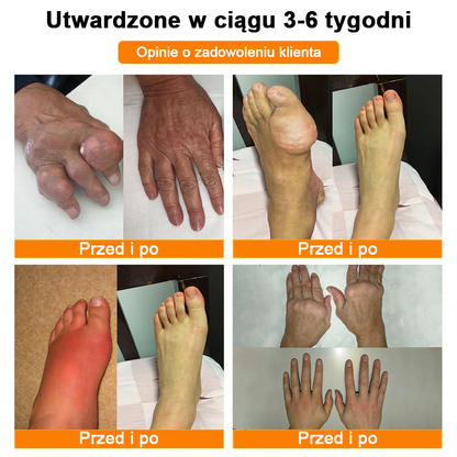 ✅Oficjalny sklep: Ouryard™ Olej magnezowy i miód w sprayu do naprawy stawów👨‍⚕️Zatwierdzony przez Polską Agencję Leków, Wyrobów Medycznych i Produktów Biologicznych (URPL)🔥