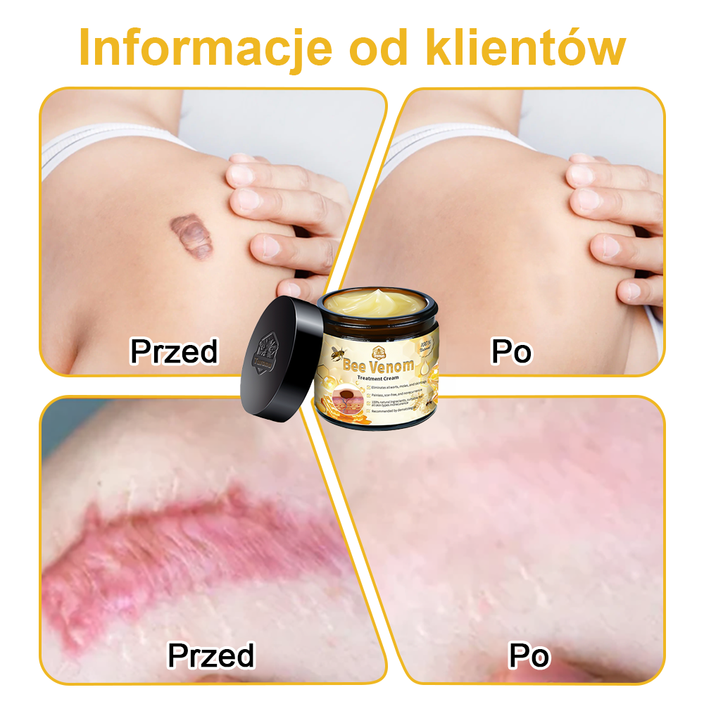 🏵️Turonu™ leczniczy krem do skóry z jadem pszczelim (zalecany przez AAD)🏵️