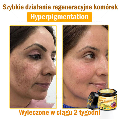 ΑPΚΑPK™ Jad Pszczoły Kompleksowy Krem🥇🥇pomaga w leczeniu problemów skórnych, takich jak: zmarszczki, blizny, plamy pigmentacyjne, rozstępy, trądzik, łuszczyca, egzema, zmiany skórne, podrażnienia, stany zapalne i inne problemy skórne🔥🔥🔥