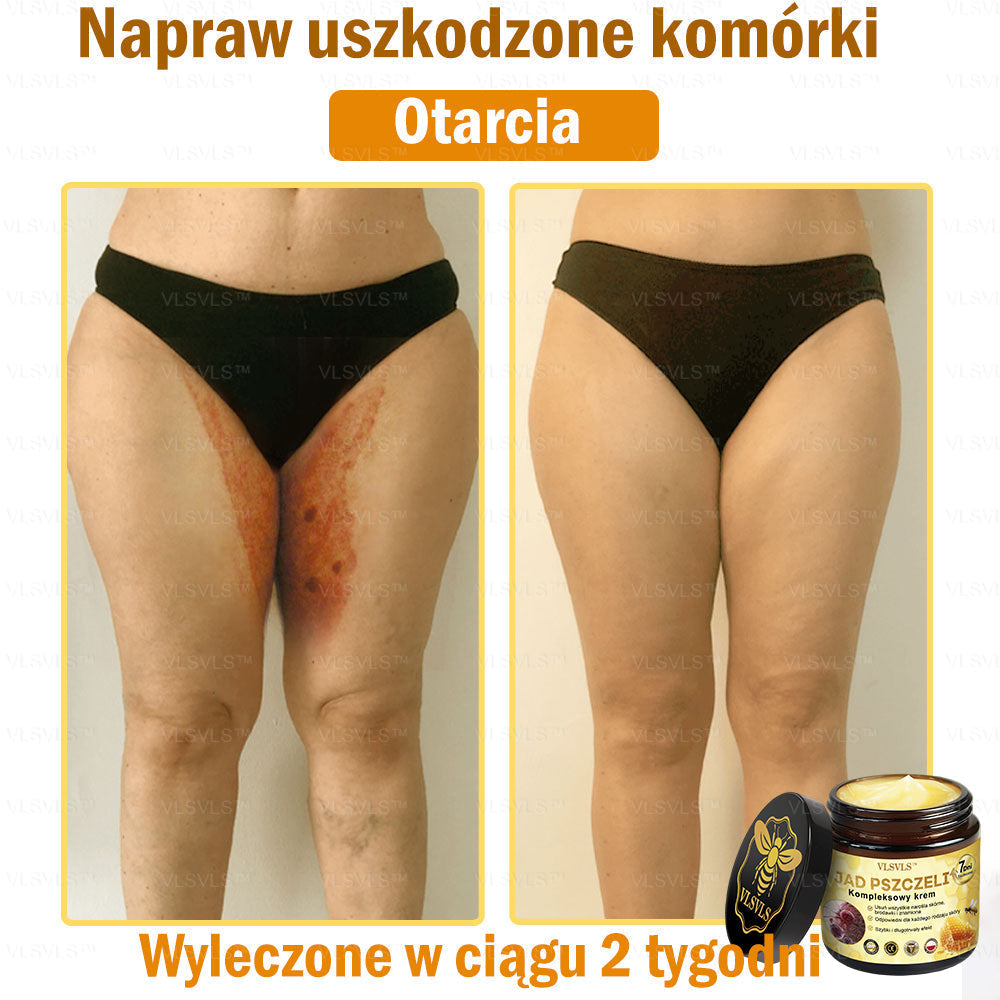 🇵🇱VLSVLS™ Krem Komprehensywny z Jadami Pszczół 🇵🇱 Rekomendowany przez Dermatologów🇵🇱