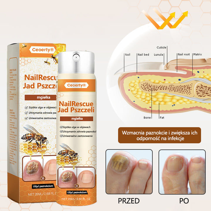 Spray z jadem pszczelim – skuteczny w leczeniu infekcji grzybiczych i zapalenia paznokci🎁