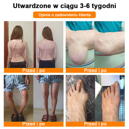 ✅Oficjalny sklep: Ouryard™ Olej magnezowy i miód w sprayu do naprawy stawów👨‍⚕️Zatwierdzony przez Polską Agencję Leków, Wyrobów Medycznych i Produktów Biologicznych (URPL)🔥