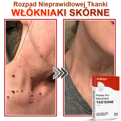 KUBOZN® Mikroigłowy Botaniczny Plaster na Usuwanie Brodawek Skórnych✨✨✨