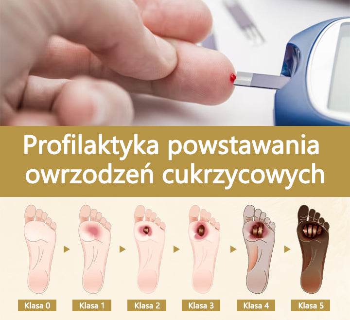 Cvreoz® Leczniczy spray z jadem pszczelim do gojenia i regeneracji ran na dłoniach i stopach🌿🌿🌿