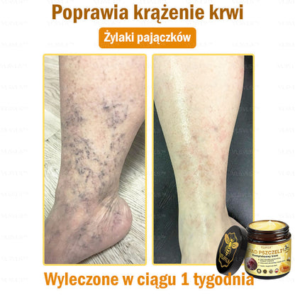 🇵🇱VLSVLS™ Krem Komprehensywny z Jadami Pszczół 🇵🇱 Rekomendowany przez Dermatologów🇵🇱