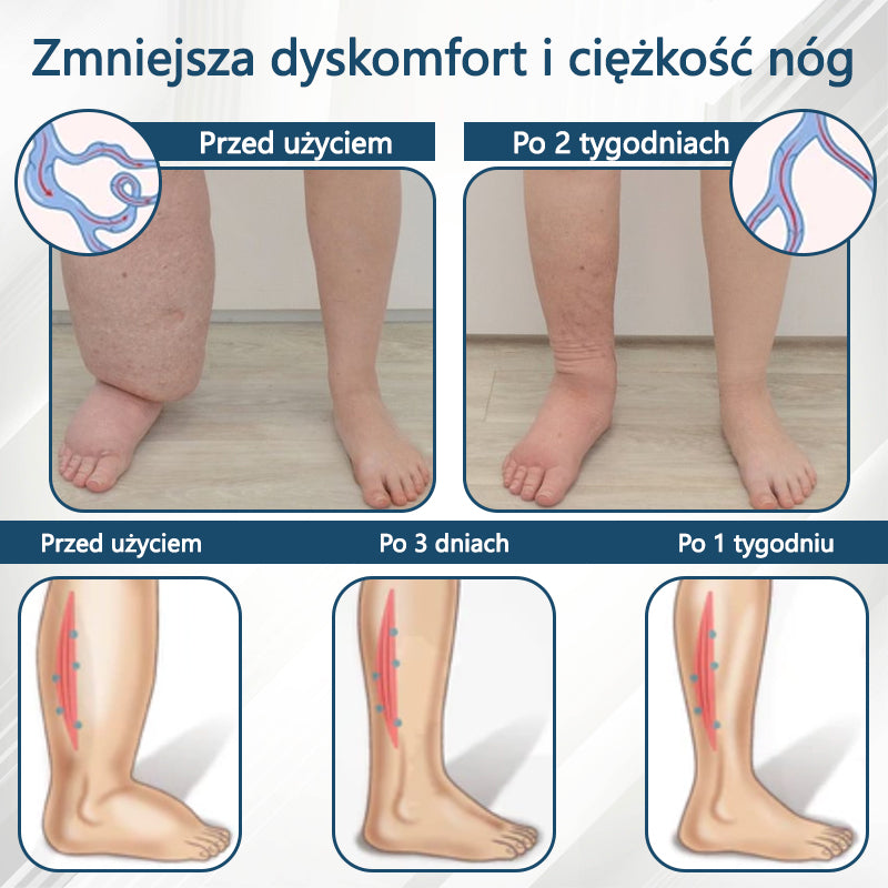 Detoksykujący krem ziołowy z czarnym kminkiem Cvreoz®🩹🩹🩹