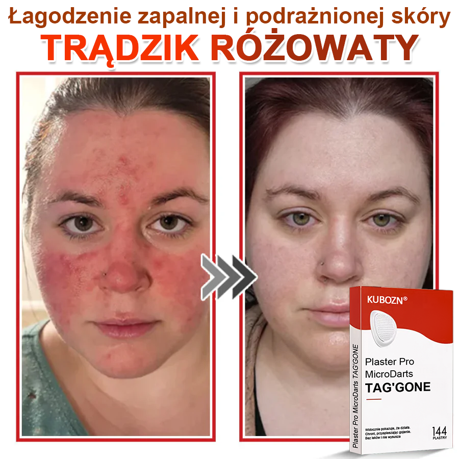 KUBOZN® Mikroigłowy Botaniczny Plaster na Usuwanie Brodawek Skórnych✨✨✨