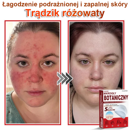 KUBOZN® Mikroigłowy botaniczny środek do usuwania narośli skórnych ✅✅✅wyprodukowano w Polsce✅