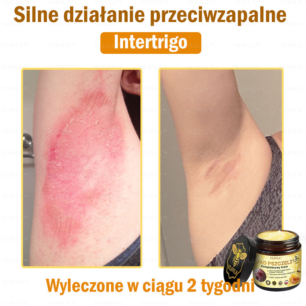 🇵🇱VLSVLS™ Krem Komprehensywny z Jadami Pszczół 🇵🇱 Rekomendowany przez Dermatologów🇵🇱