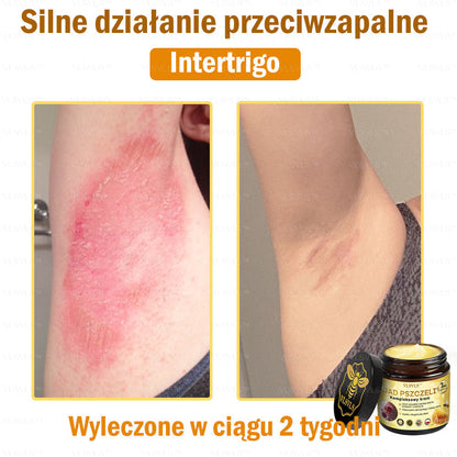 🇵🇱VLSVLS™ Krem Komprehensywny z Jadami Pszczół 🇵🇱 Rekomendowany przez Dermatologów🇵🇱
