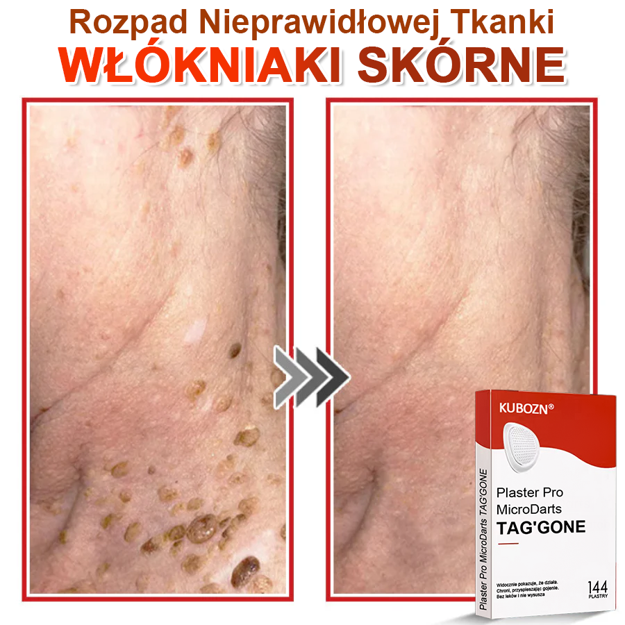 KUBOZN® Mikroigłowy Botaniczny Plaster na Usuwanie Brodawek Skórnych✨✨✨