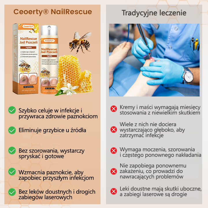 Spray z jadem pszczelim – skuteczny w leczeniu infekcji grzybiczych i zapalenia paznokci🎁