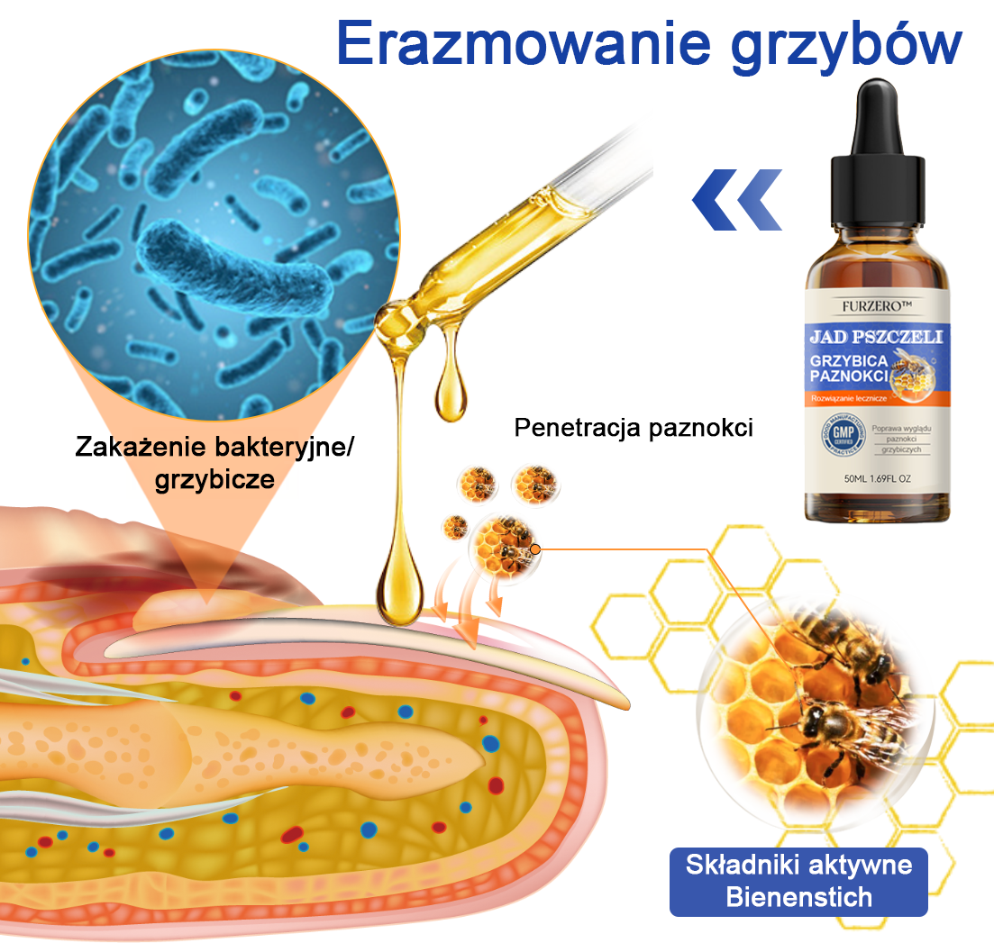 🐝🐝Furzero™ Bienengift Nagelpilz Leczenie: Całkowite rozwiązanie problemu grzybicy paznokci🌟👣👣👣