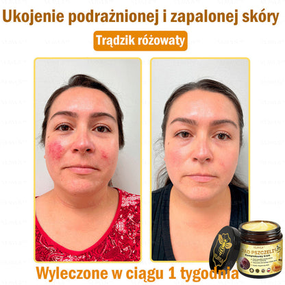 🇵🇱VLSVLS™ Krem Komprehensywny z Jadami Pszczół 🇵🇱 Rekomendowany przez Dermatologów🇵🇱