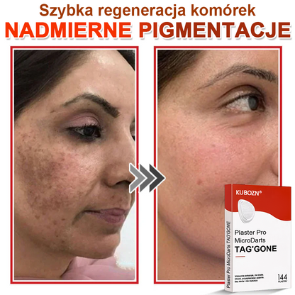 KUBOZN® Mikroigłowy Botaniczny Plaster na Usuwanie Brodawek Skórnych✨✨✨