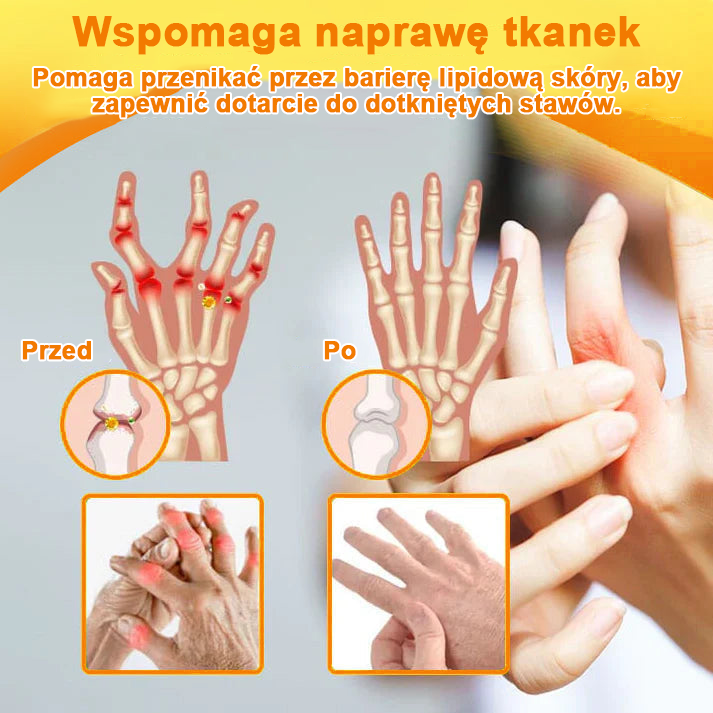 ✅Oficjalny sklep: Ouryard™ Olej magnezowy i miód w sprayu do naprawy stawów👨‍⚕️Zatwierdzony przez Polską Agencję Leków, Wyrobów Medycznych i Produktów Biologicznych (URPL)🔥