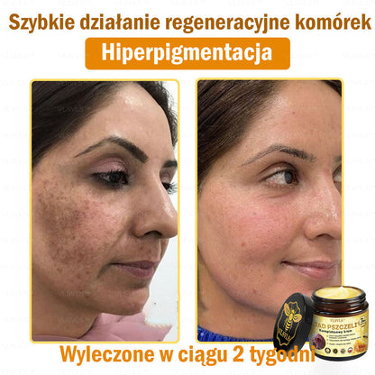 🇵🇱VLSVLS™ Krem Komprehensywny z Jadami Pszczół 🇵🇱 Rekomendowany przez Dermatologów🇵🇱