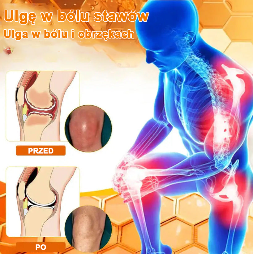 ✅Oficjalny sklep: Ouryard™ Olej magnezowy i miód w sprayu do naprawy stawów👨‍⚕️Zatwierdzony przez Polską Agencję Leków, Wyrobów Medycznych i Produktów Biologicznych (URPL)🔥