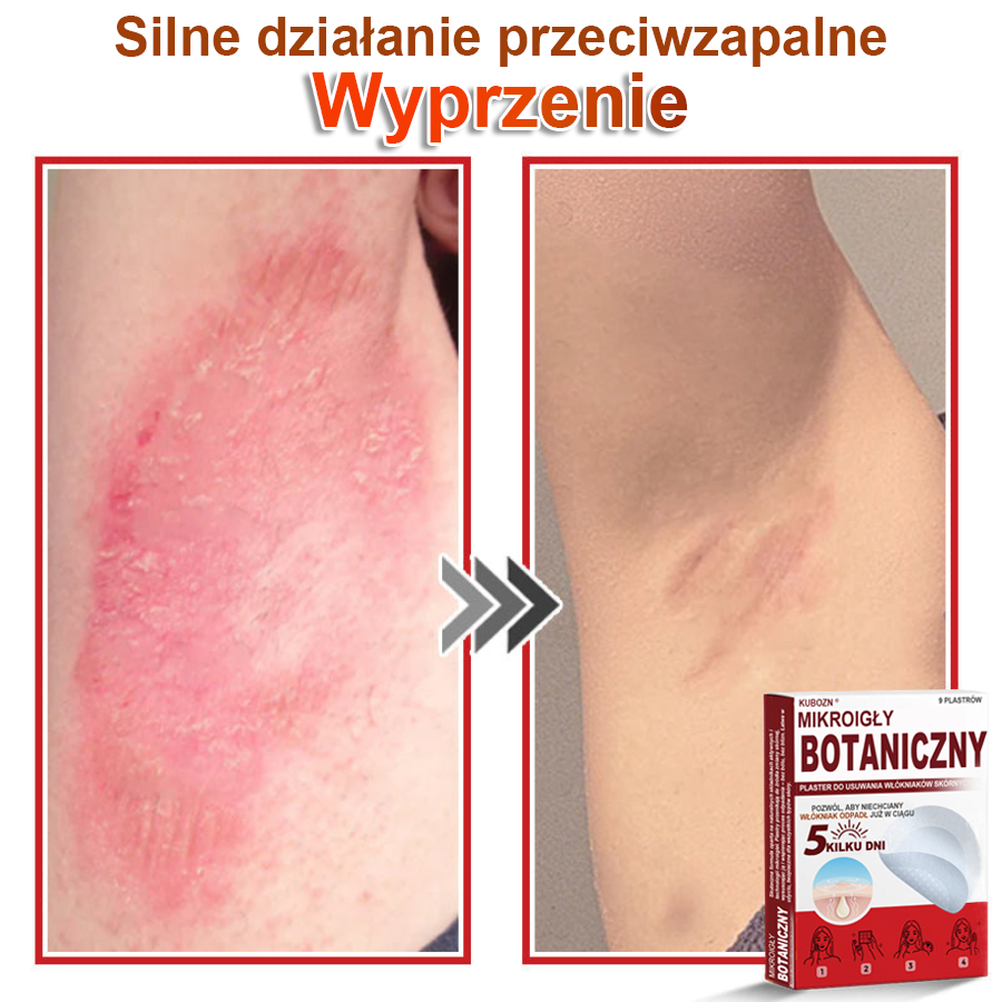 KUBOZN® Mikroigłowy botaniczny środek do usuwania narośli skórnych ✅✅✅wyprodukowano w Polsce✅