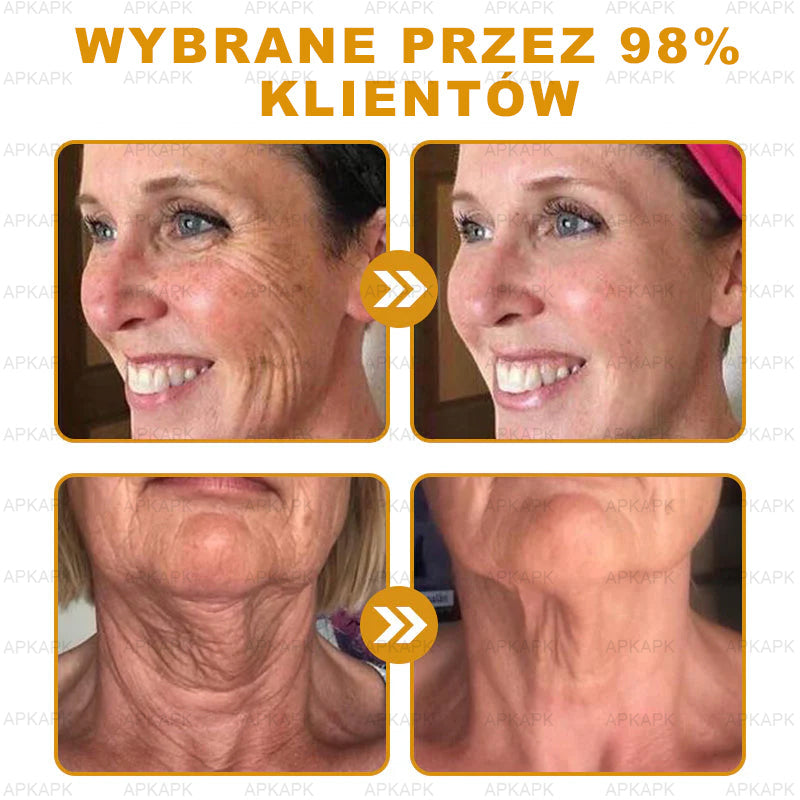 ΑPΚΑPK™ Jad Pszczoły Kompleksowy Krem🥇🥇pomaga w leczeniu problemów skórnych, takich jak: zmarszczki, blizny, plamy pigmentacyjne, rozstępy, trądzik, łuszczyca, egzema, zmiany skórne, podrażnienia, stany zapalne i inne problemy skórne🔥🔥🔥