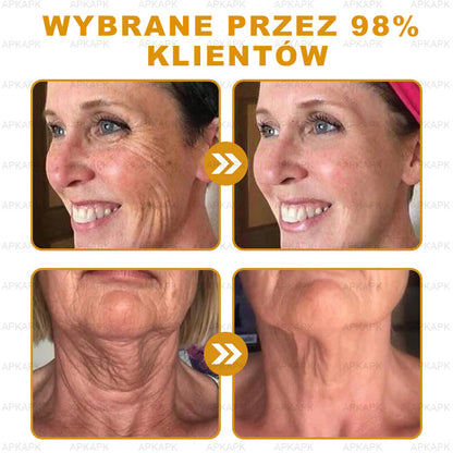 ΑPΚΑPK™ Jad Pszczoły Kompleksowy Krem🥇🥇pomaga w leczeniu problemów skórnych, takich jak: zmarszczki, blizny, plamy pigmentacyjne, rozstępy, trądzik, łuszczyca, egzema, zmiany skórne, podrażnienia, stany zapalne i inne problemy skórne🔥🔥🔥